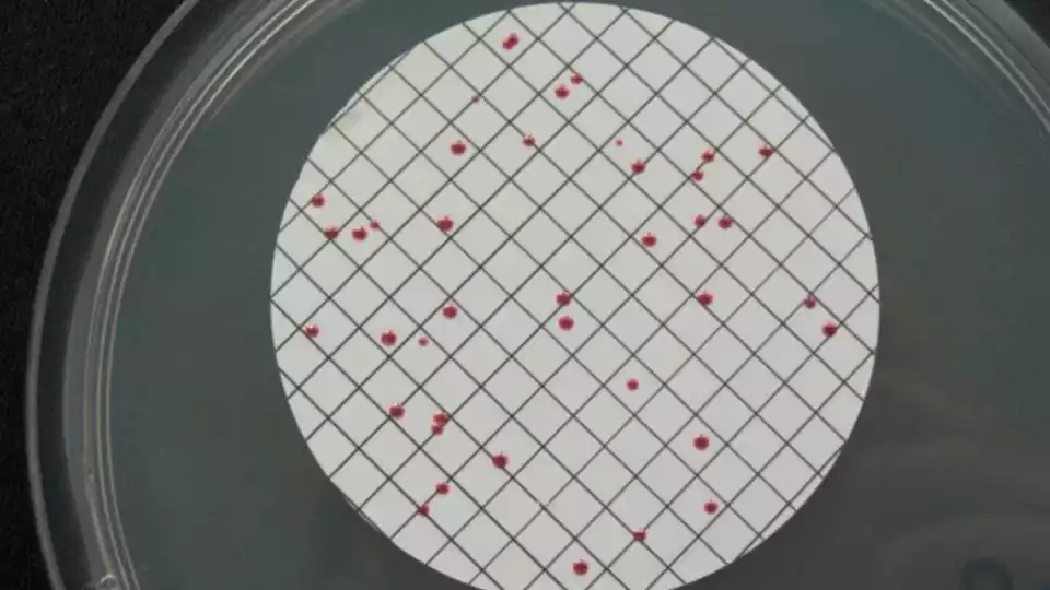 enterococos Enterococos al microscopio